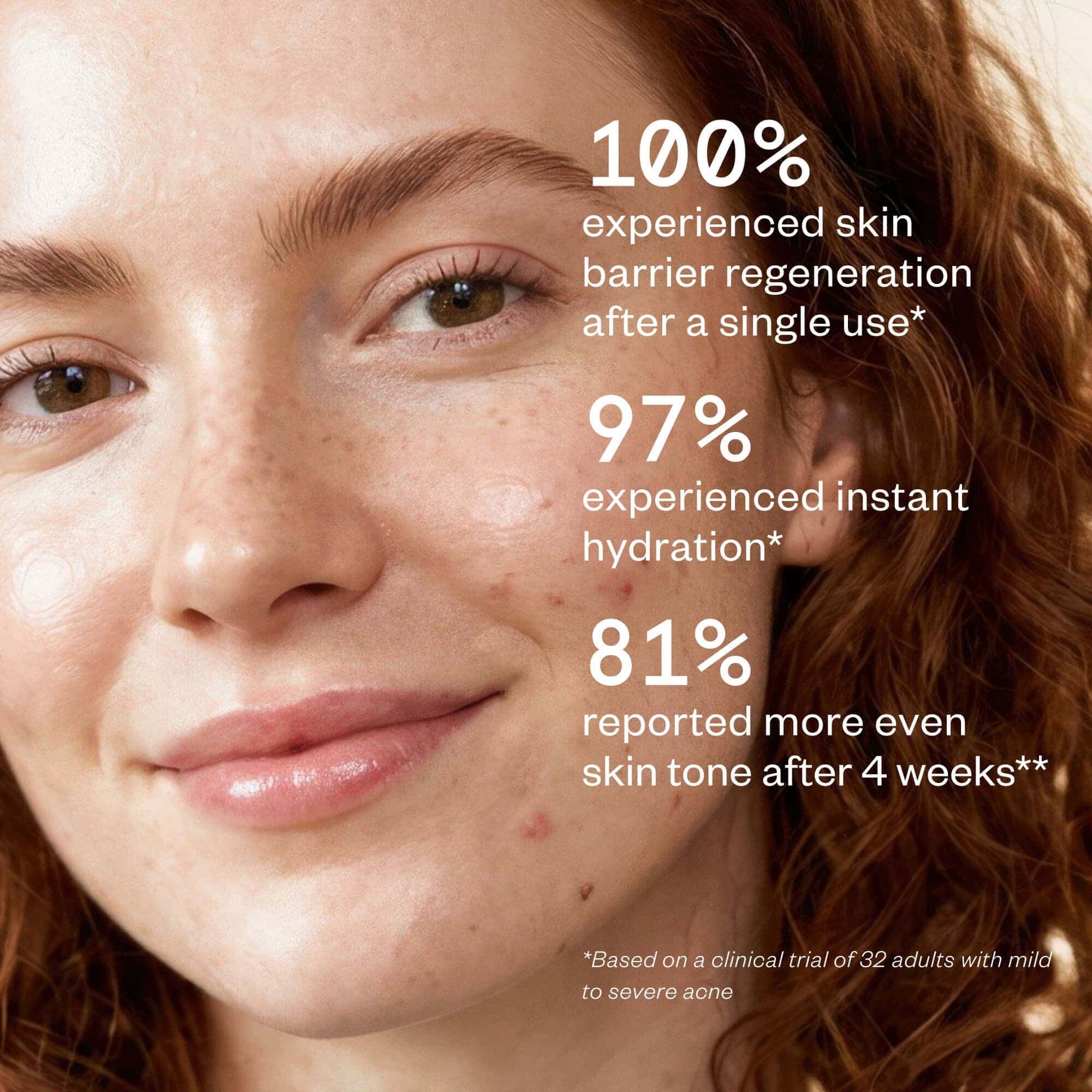 Hypothesis Balancing + Brightening Gel Cream, 1.7 fl. oz., , large