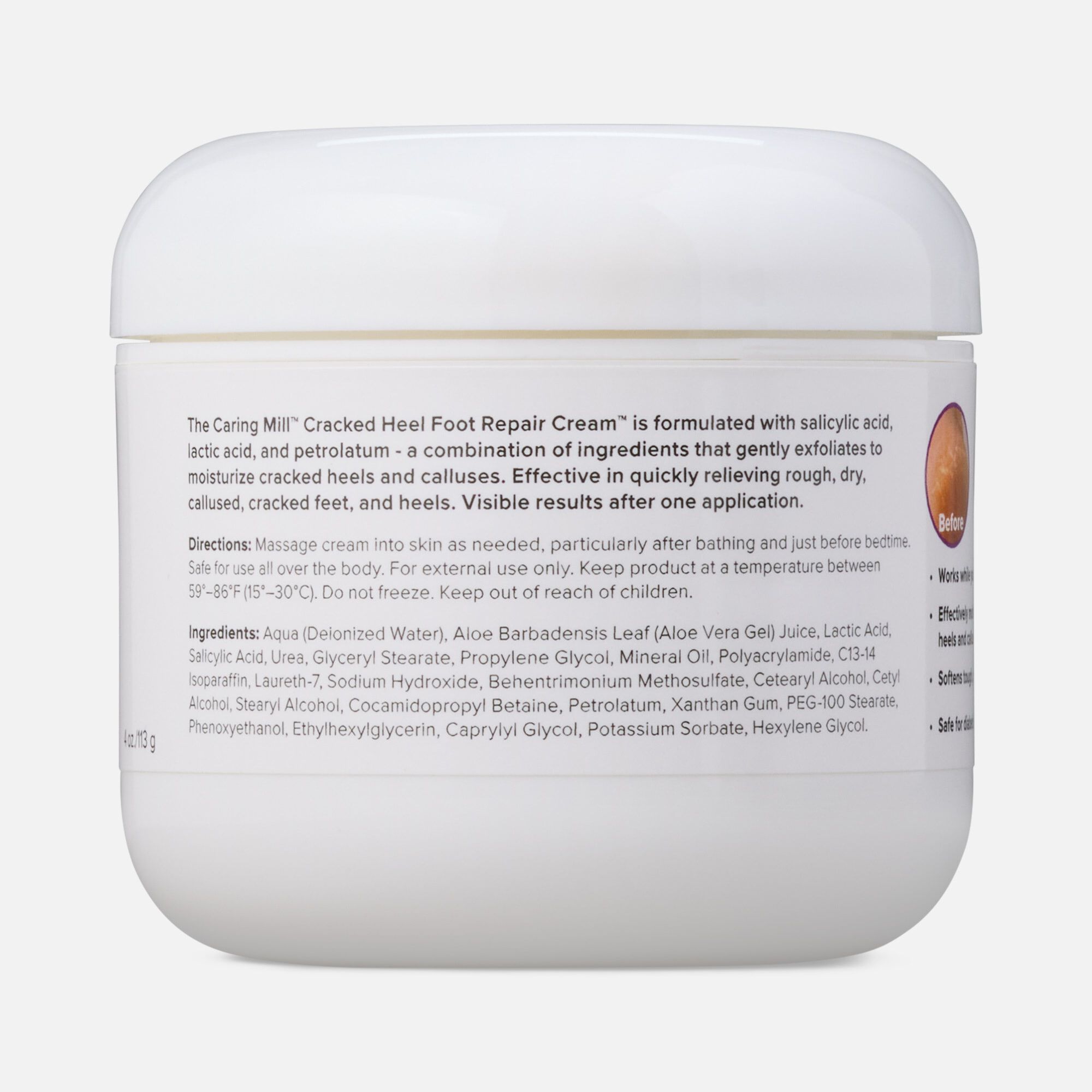 Caring Mill™ Cracked Heel Foot Repair Cream, , large