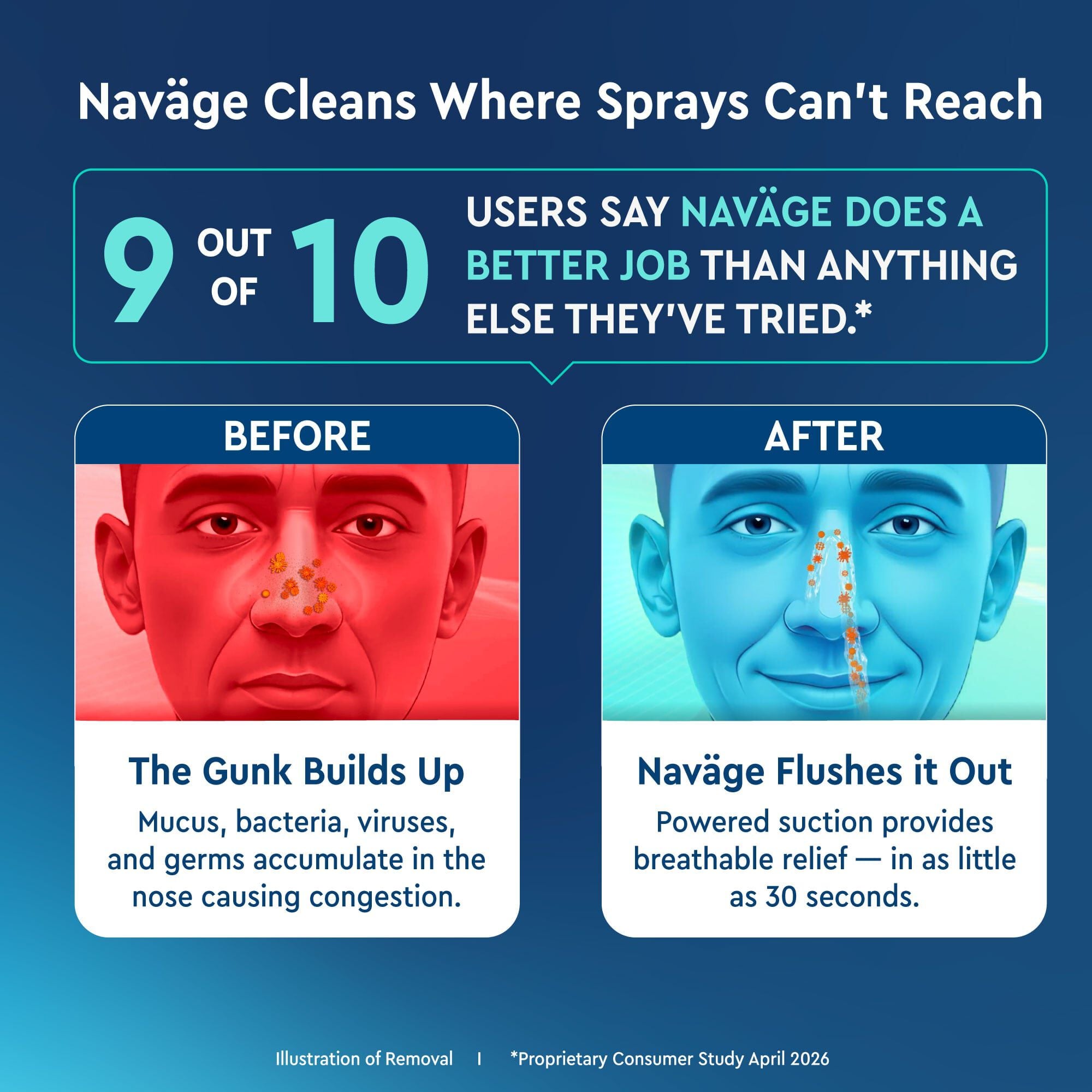 Navage® Advanced Powered Nose Cleaner Bundle, , large